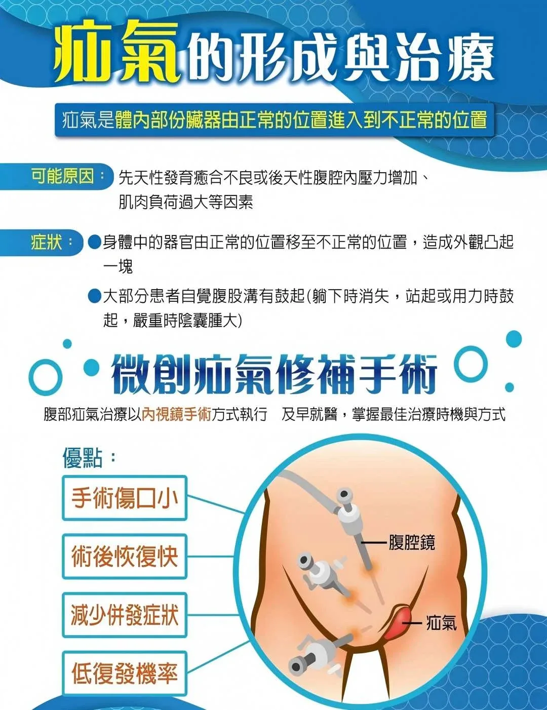 疝氣