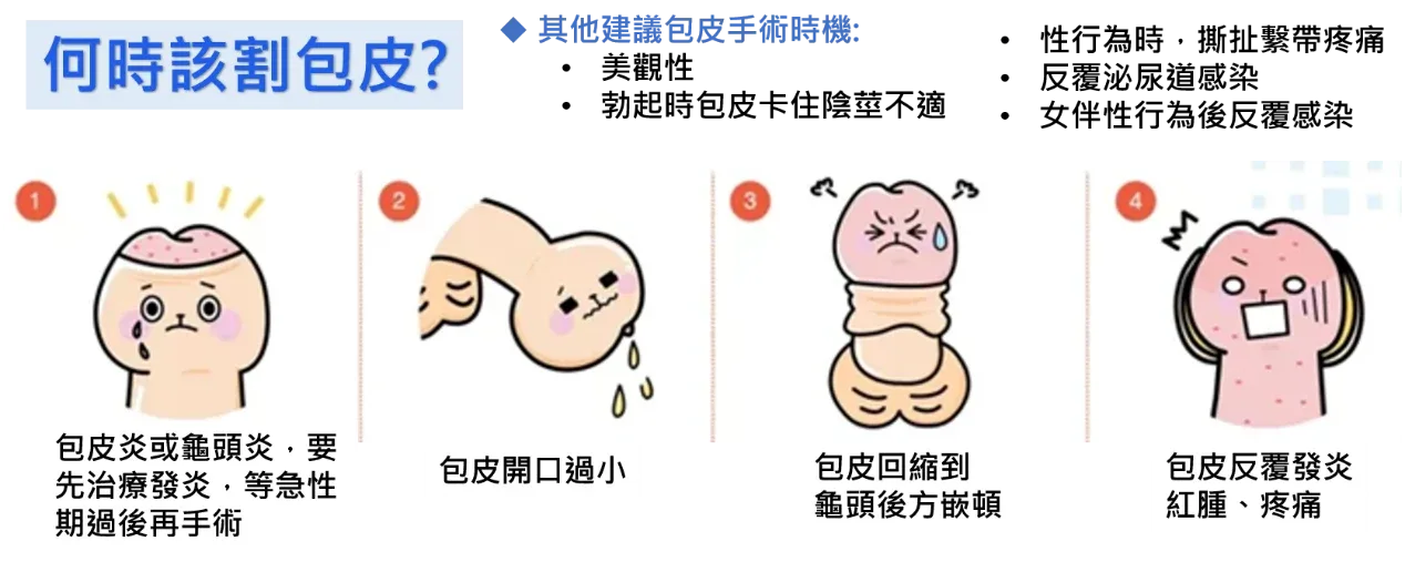 何時該割包皮