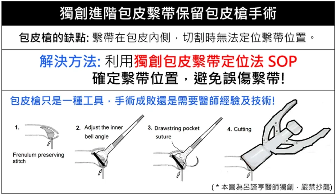 改良式包皮槍手術於美國泌尿科醫學會發表